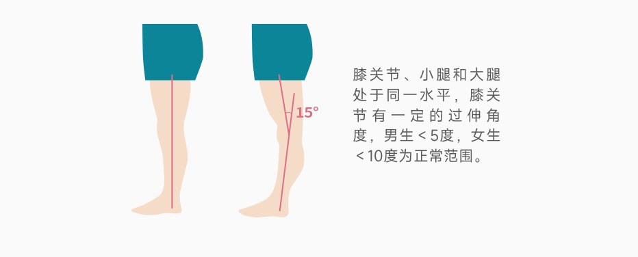 膝超伸参考范围